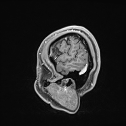 Click on the Serie image to view the images of VILLANUEVA, WILLIAM A.